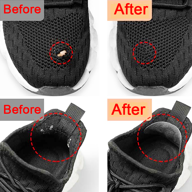 Sportschuh-Reparaturpflaster f – Sneaker Care Kit Bewertung und Preis